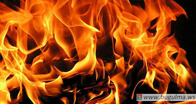 Житель Бугульмы получил при пожаре 60 процентов ожогов тела