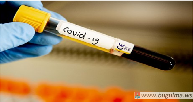 Врачи Татарстана выявили 63 новых заболевших Covid-19 за сутки.