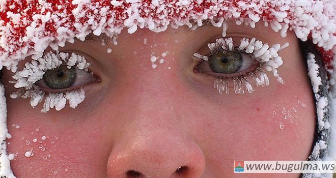 Врачи Татарстана рассказали, по каким симптомам можно определить обморожение.